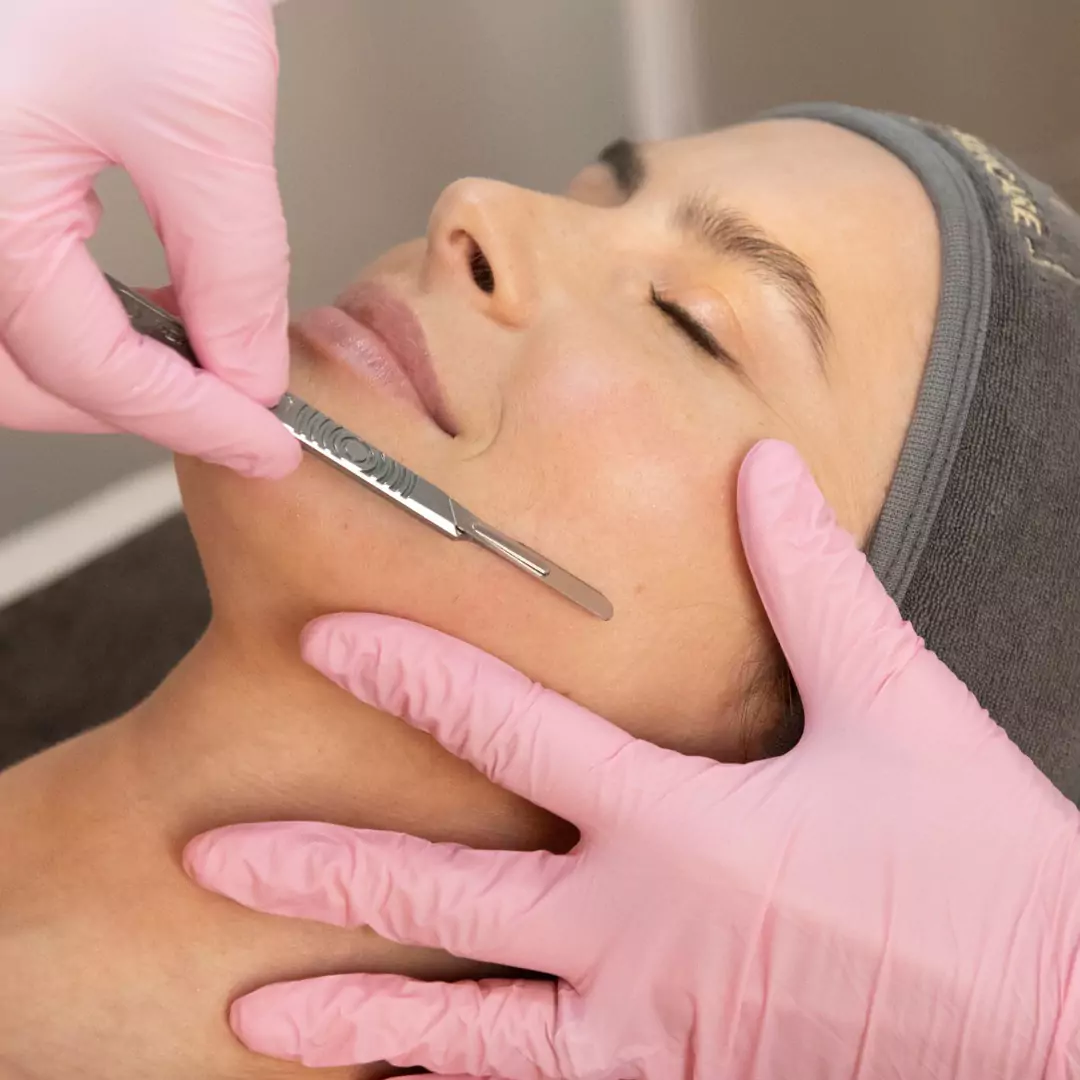 Dermaplaning in Bourbonnais