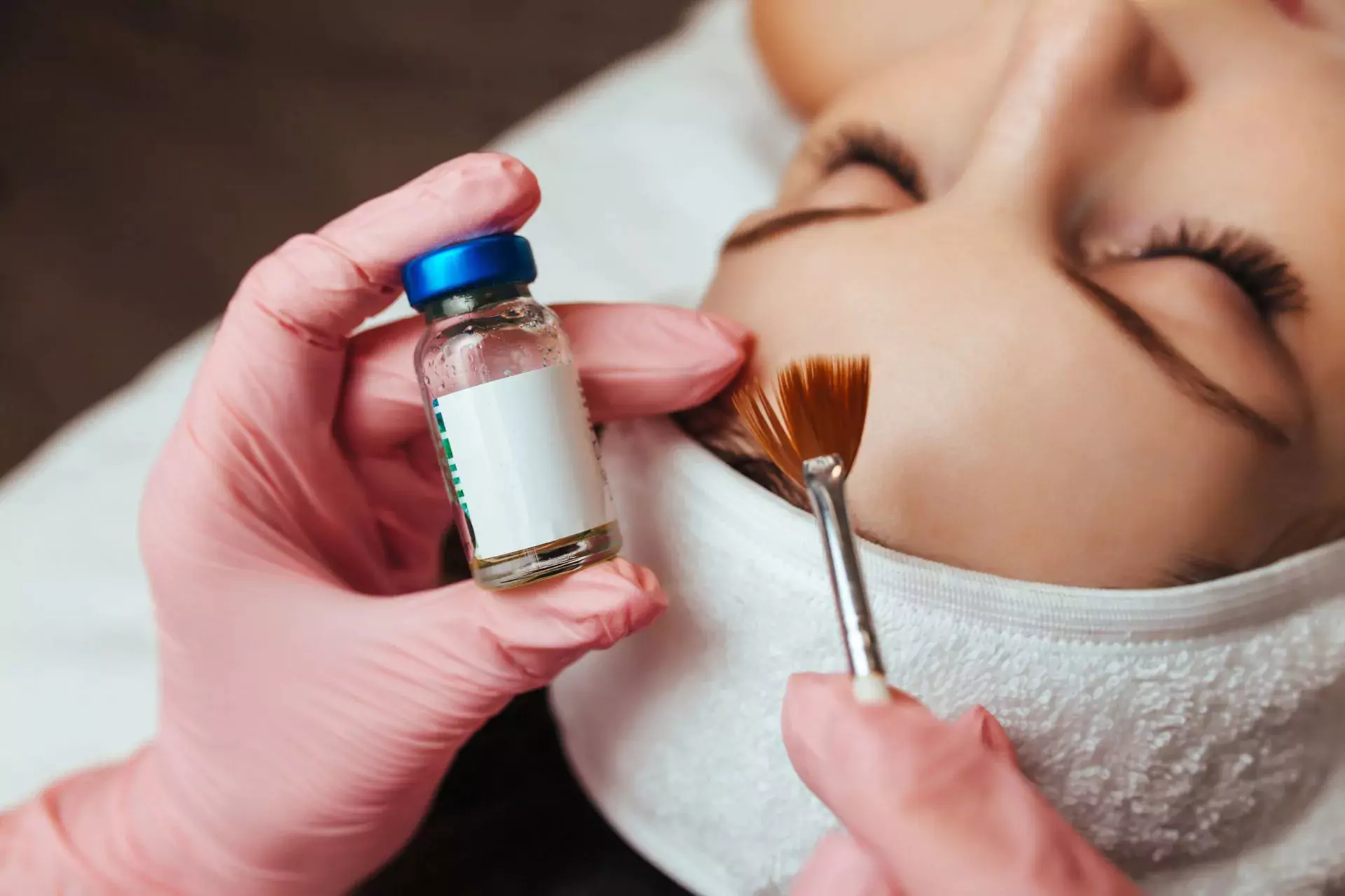 Express chemical peel in Bourbonnais
