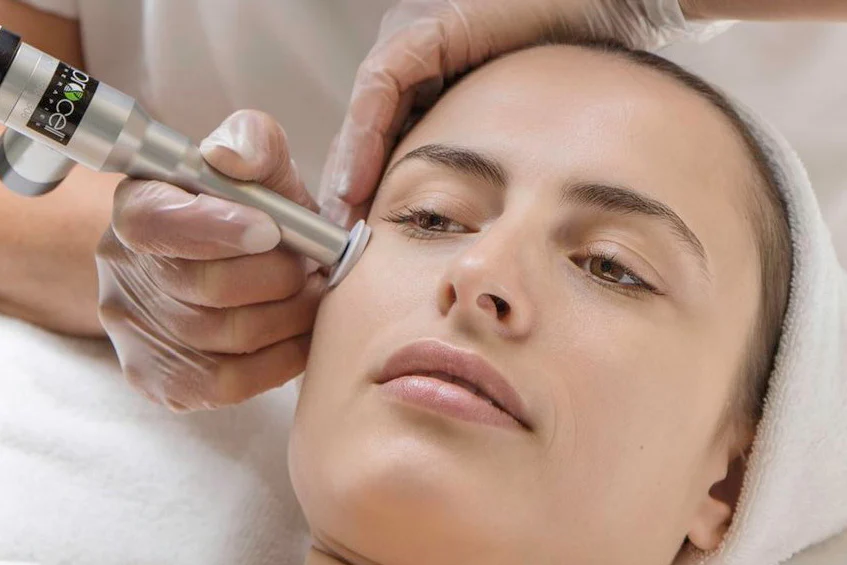 Microchanneling procell therapies in Bourbonnais