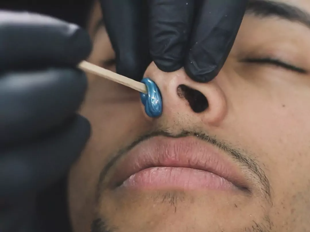 Nose Waxing in Bourbonnais