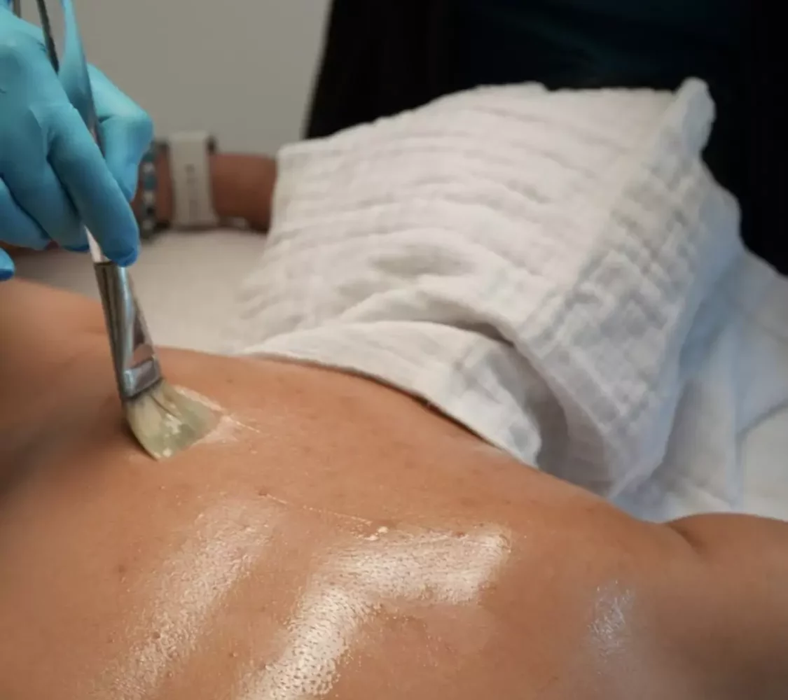 Completing a back facial in Bourbonnais